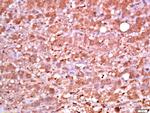 Phospho-PDK1 (Ser241) Antibody in Immunohistochemistry (Paraffin) (IHC (P))
