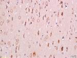 Phospho-PDK1 (Ser241) Antibody in Immunohistochemistry (Paraffin) (IHC (P))
