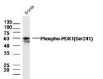 Phospho-PDK1 (Ser241) Antibody in Western Blot (WB)