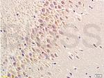 Phospho-PERK (Thr980) Antibody in Immunohistochemistry (Paraffin) (IHC (P))
