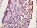Phospho-PFK2 (Ser467) Antibody in Immunohistochemistry (Paraffin) (IHC (P))