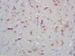 Phospho-PKC alpha/beta 2 (Thr638, Thr641) Antibody in Immunohistochemistry (Paraffin) (IHC (P))