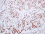 Phospho-PKM2 (Tyr105) Antibody in Immunohistochemistry (Paraffin) (IHC (P))