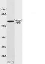 Phospho-PKM2 (Tyr105) Antibody in Western Blot (WB)