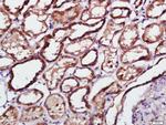 Phospho-PKR (Thr451) Antibody in Immunohistochemistry (Paraffin) (IHC (P))