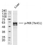 Phospho-PKR (Thr451) Antibody in Western Blot (WB)