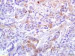 Phospho-PLK1 (Thr210) Antibody in Immunohistochemistry (Paraffin) (IHC (P))