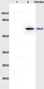 Phospho-Paxillin (Tyr118) Antibody in Western Blot (WB)