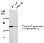 Phospho-Progesterone Receptor (Ser190) Antibody in Western Blot (WB)
