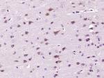 Phospho-p90RSK (Ser380) Antibody in Immunohistochemistry (Paraffin) (IHC (P))
