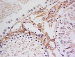 Phospho-p90RSK (Thr359, Ser363) Antibody in Immunohistochemistry (Paraffin) (IHC (P))