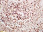 Phospho-p90RSK (Thr573) Antibody in Immunohistochemistry (Paraffin) (IHC (P))