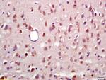 Phospho-RSK2 (Ser227) Antibody in Immunohistochemistry (Paraffin) (IHC (P))