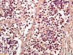 Phospho-RSK2 (Ser227) Antibody in Immunohistochemistry (Paraffin) (IHC (P))