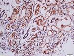 Phospho-RSK2 (Tyr529) Antibody in Immunohistochemistry (Paraffin) (IHC (P))