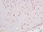 Phospho-B-Raf (Ser602) Antibody in Immunohistochemistry (Paraffin) (IHC (P))