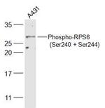 Phospho-RPS6 (Ser240, Ser244) Antibody in Western Blot (WB)