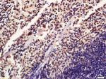 Phospho-SATB1 (Ser47) Antibody in Immunohistochemistry (Paraffin) (IHC (P))