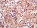 Phospho-SGK1 (Ser422) Antibody in Immunohistochemistry (Paraffin) (IHC (P))