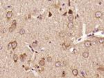 Phospho-Pyk2 (Tyr402) Antibody in Immunohistochemistry (Paraffin) (IHC (P))