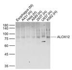 ALOX12 Antibody in Western Blot (WB)