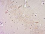 Phospho-Pyk2 (Tyr881) Antibody in Immunohistochemistry (Paraffin) (IHC (P))