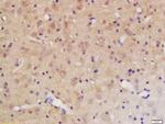 Phospho-PTPN11 (Tyr584) Antibody in Immunohistochemistry (Paraffin) (IHC (P))