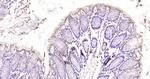 Phospho-SMC1 (Ser360) Antibody in Immunohistochemistry (Paraffin) (IHC (P))