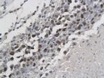Phospho-SMC1 (Ser957) Antibody in Immunohistochemistry (Paraffin) (IHC (P))