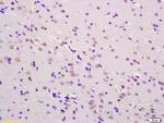 Phospho-SHC (Tyr349, Tyr350) Antibody in Immunohistochemistry (Paraffin) (IHC (P))