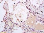 Phospho-SHC (Tyr349, Tyr350) Antibody in Immunohistochemistry (Paraffin) (IHC (P))
