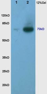 Phospho-TORC2 (Ser171) Antibody in Western Blot (WB)