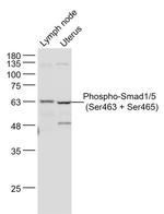 Phospho-Smad1/5 (Ser463, Ser465) Antibody in Western Blot (WB)