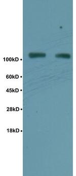 Phospho-TIF1 beta (Ser824) Antibody in Immunohistochemistry (Paraffin) (IHC (P))