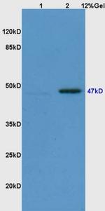 Phospho-Smad3 (Ser423, Ser425) Antibody in Western Blot (WB)