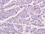 Phospho-STAT1 (Ser727) Antibody in Immunohistochemistry (Paraffin) (IHC (P))