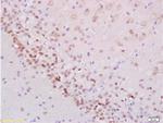 Phospho-Stat2 (Tyr690) Antibody in Immunohistochemistry (Paraffin) (IHC (P))