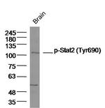 Phospho-Stat2 (Tyr690) Antibody in Western Blot (WB)