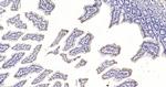 Phospho-Stat4 (Tyr693) Antibody in Immunohistochemistry (Paraffin) (IHC (P))