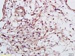 Phospho-Syk (Tyr525, Tyr526) Antibody in Immunohistochemistry (Paraffin) (IHC (P))