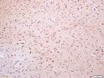 Phospho-TAK1 (Thr184) Antibody in Immunohistochemistry (Paraffin) (IHC (P))