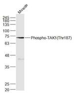 Phospho-TAK1 (Thr187) Antibody in Western Blot (WB)