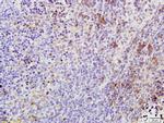 Phospho-TAK1 (Thr184, Thr187) Antibody in Immunohistochemistry (Paraffin) (IHC (P))