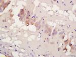 Phospho-TBK1 (Ser172) Antibody in Immunohistochemistry (Paraffin) (IHC (P))