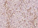 Phospho-Tuberin (Thr927) Antibody in Immunohistochemistry (Paraffin) (IHC (P))