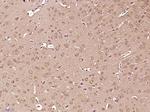 Phospho-Tuberin (Thr927) Antibody in Immunohistochemistry (Paraffin) (IHC (P))