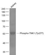 Phospho-TNK1 (Tyr277) Antibody in Western Blot (WB)