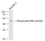 Phospho-MAP3K8 (Ser400) Antibody in Western Blot (WB)