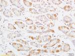 Phospho-MAP3K8 (Thr290) Antibody in Immunohistochemistry (Paraffin) (IHC (P))