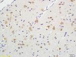 Phospho-TrkA (Tyr496) Antibody in Immunohistochemistry (Paraffin) (IHC (P))